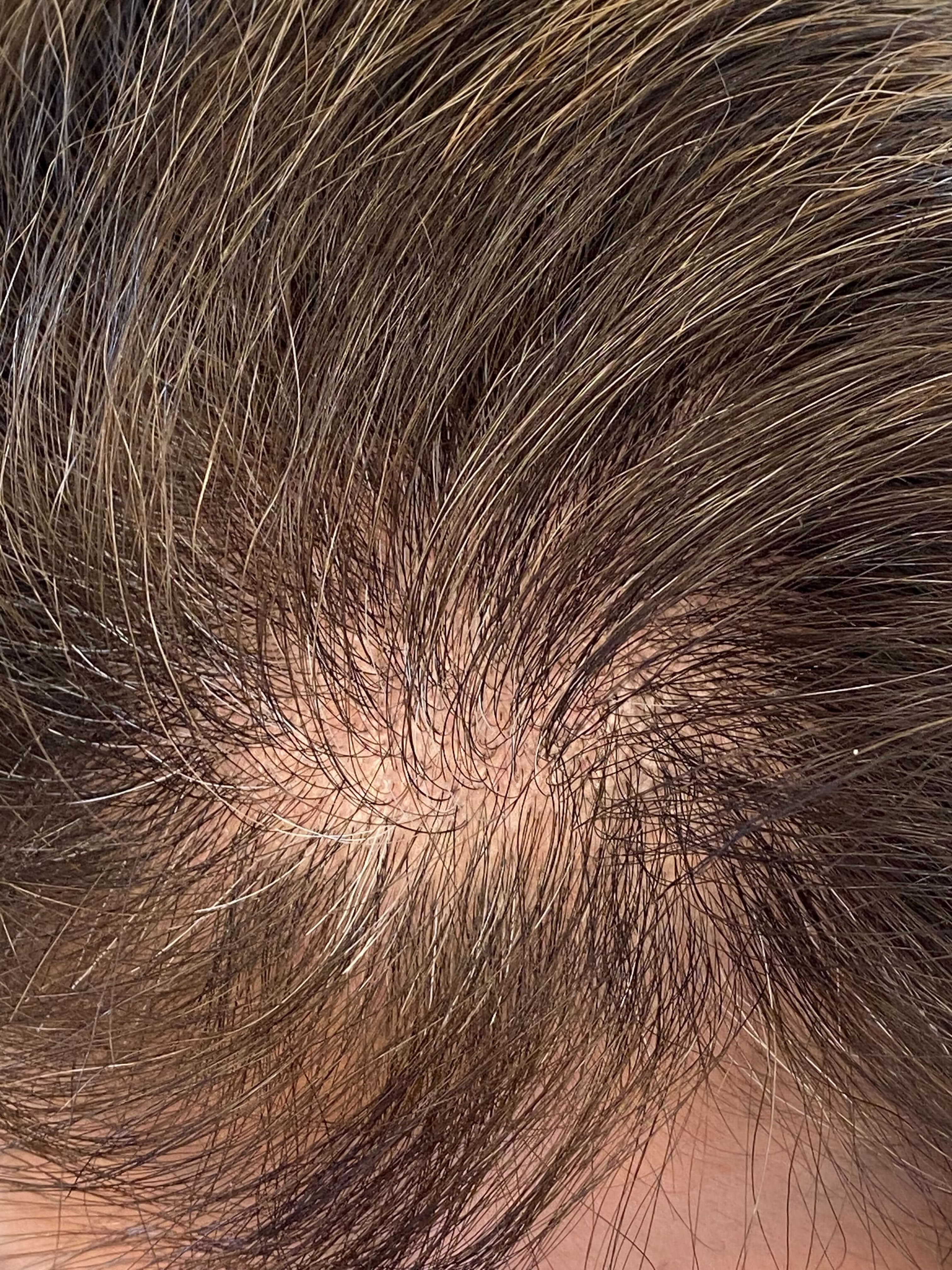 Take a Hair Assessment
