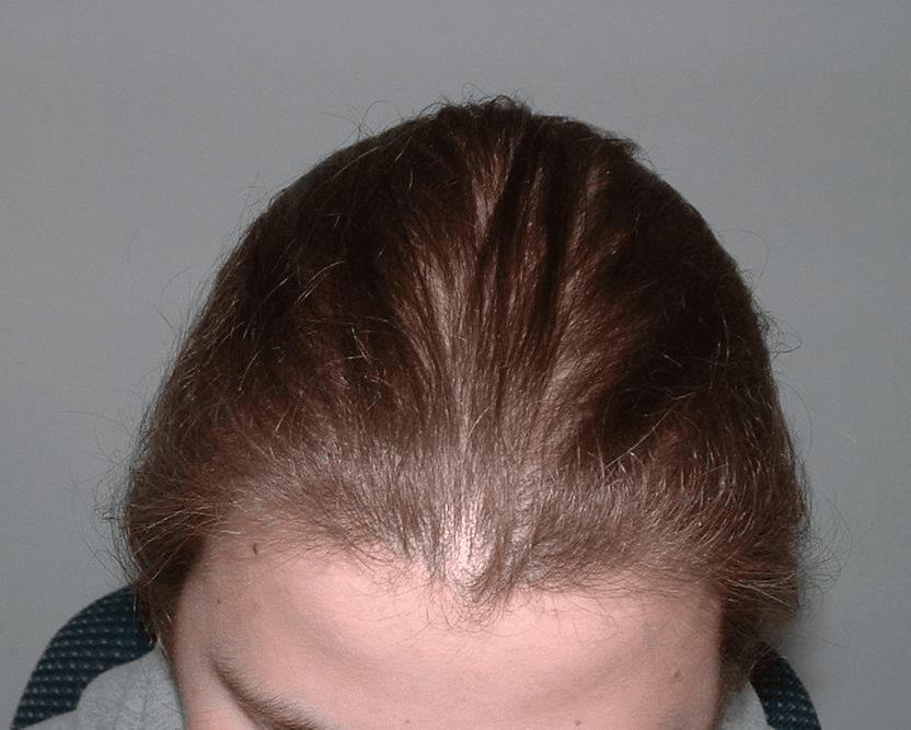 Overall Hair Health